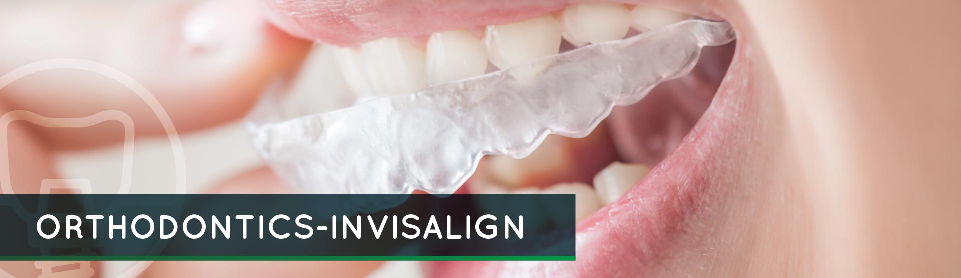 Invisalign - Elegant Dental Care